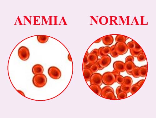 Reference Ranges and how they are important in lab test results health ...